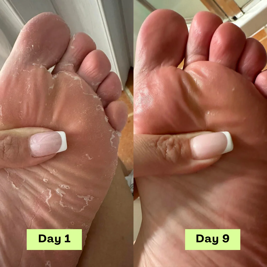 1 + 2 GRATIS IDAG | DermaCure™ - Image 2