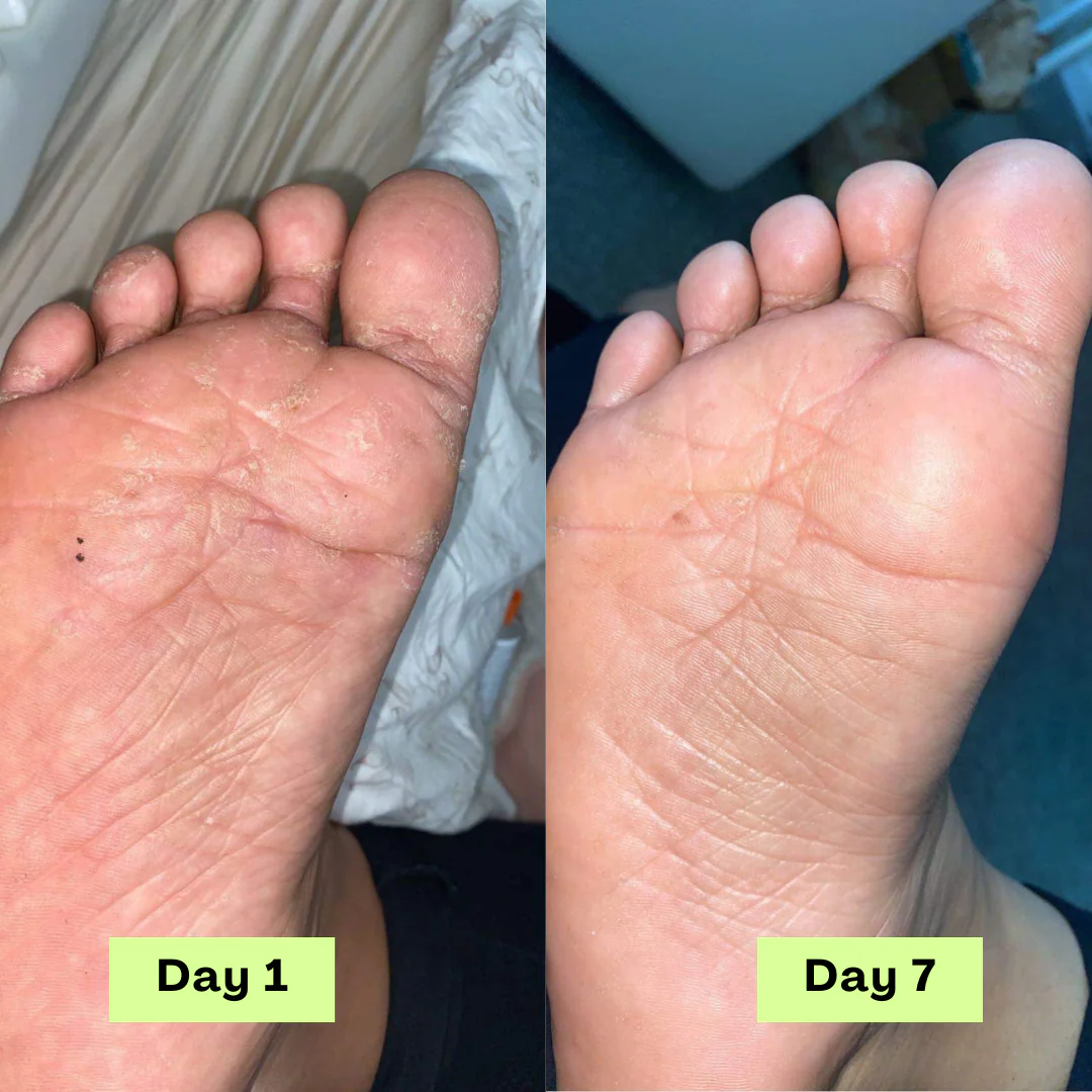 1 + 2 GRATIS IDAG | DermaCure™ - Image 3