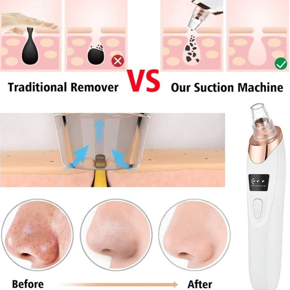 TILLFÄLLIGT 50% OFF | DermaVeo™ - Image 2