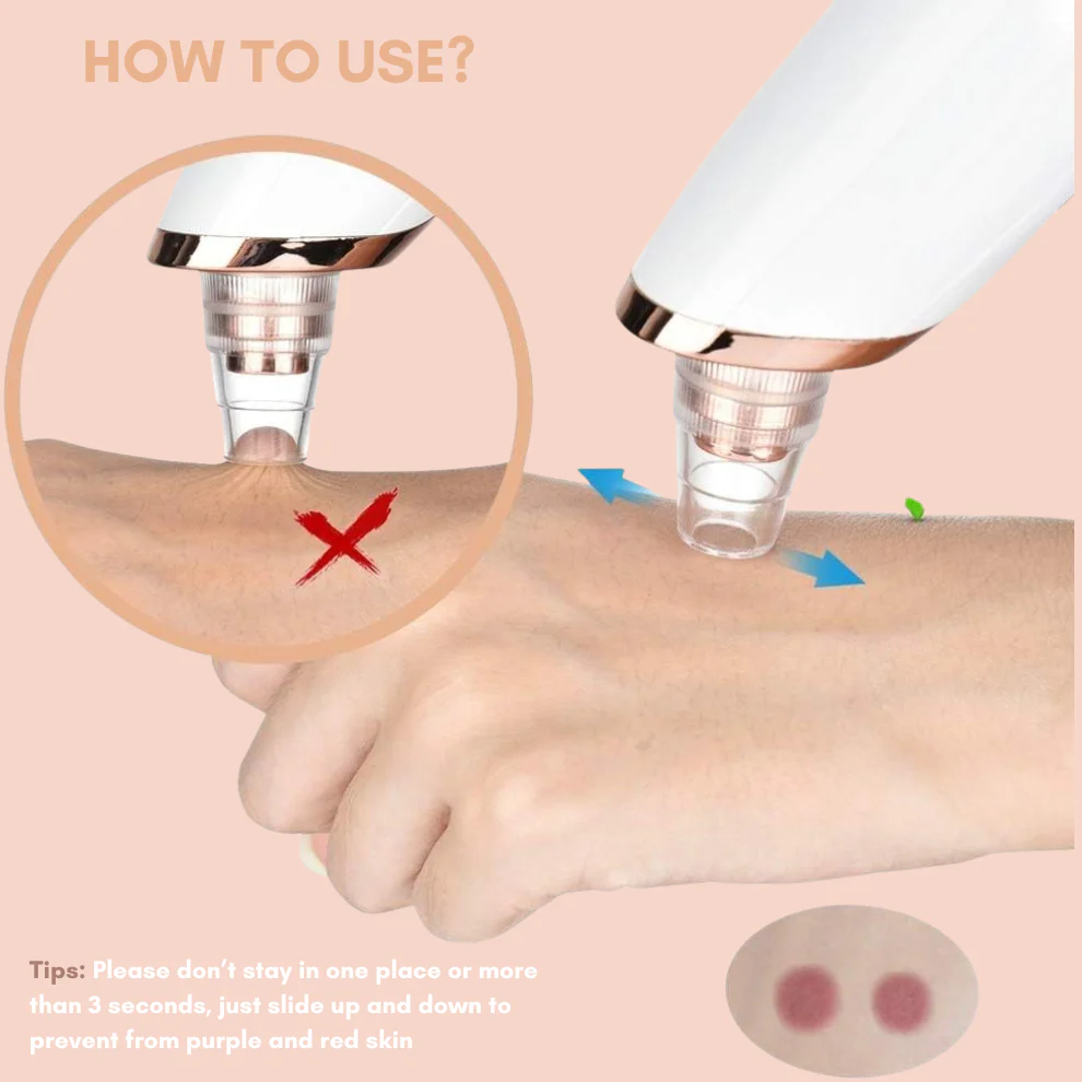 TILLFÄLLIGT 50% OFF | DermaVeo™ - Image 4