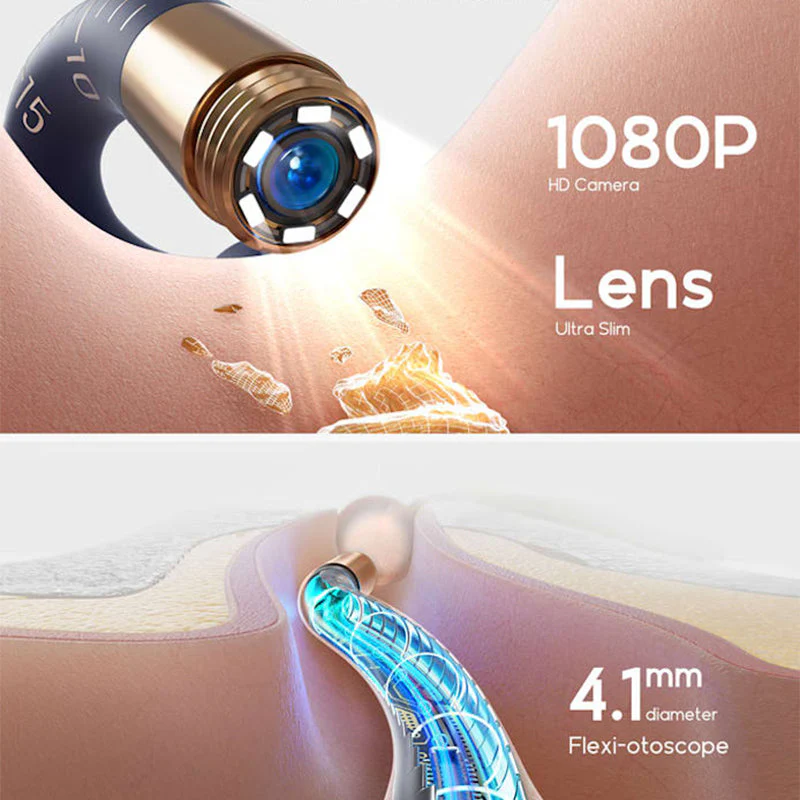 TILLFÄLLIGT 50% OFF | EarVue™ - Image 4