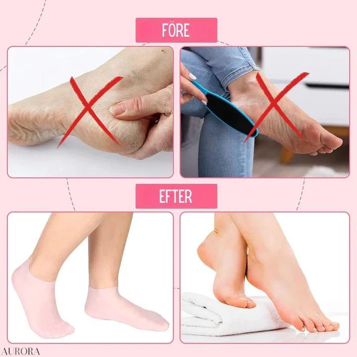 1 + 1 GRATIS IDAG | HeelHaven™ - Återupplivande silikonstrumpor - Image 4