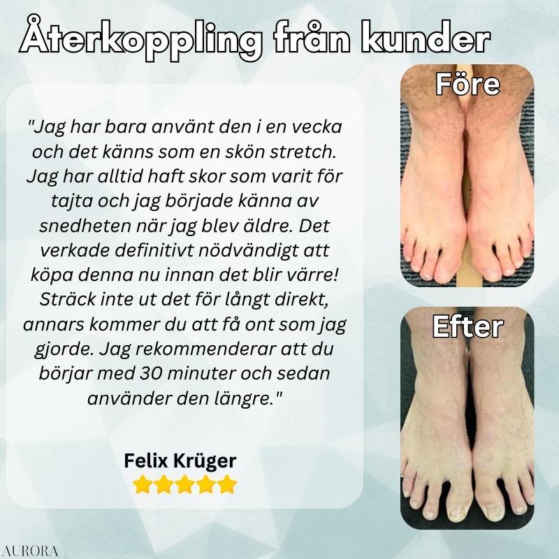 OrthoAlign™ – Korrigerare för snea tår | BEGRÄNSAD 50%-75% RABATT - Image 13