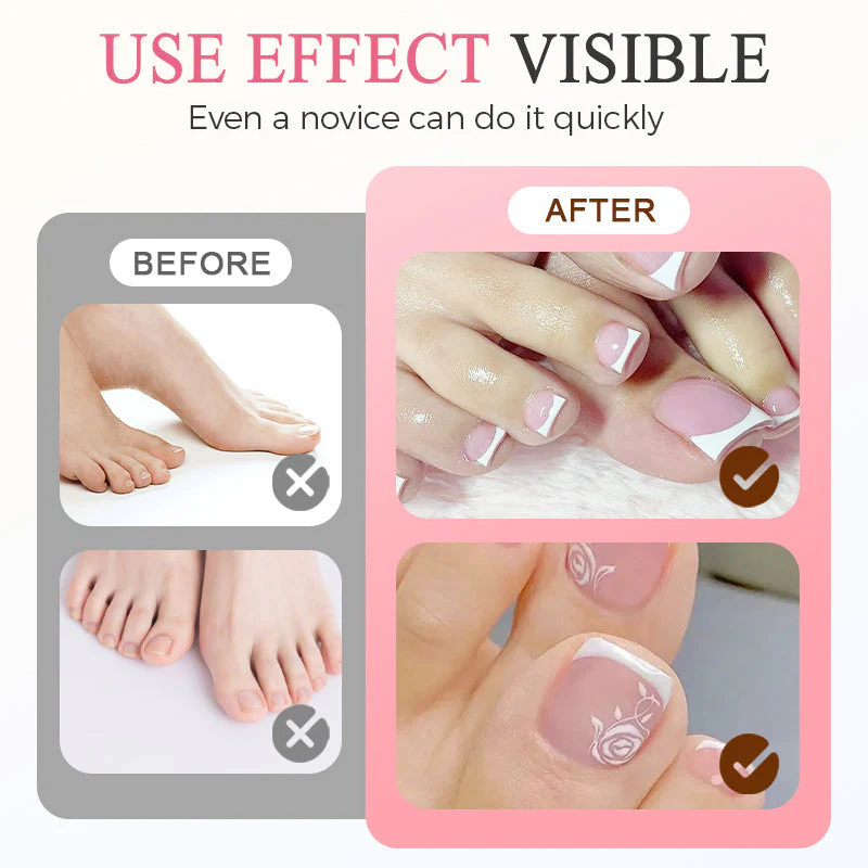 TILLFÄLLIGT 50% OFF | PressNails™ - Image 2