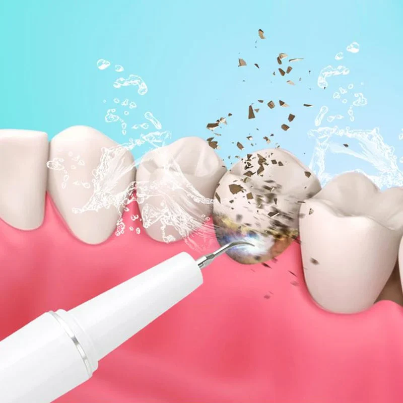 TILLFÄLLIGT 50% OFF | SonicSmile™ - Image 3
