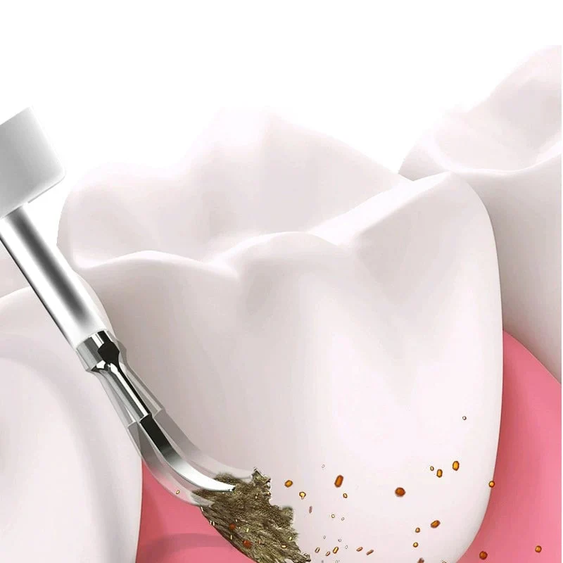 TILLFÄLLIGT 50% OFF | SonicSmile™ - Image 4
