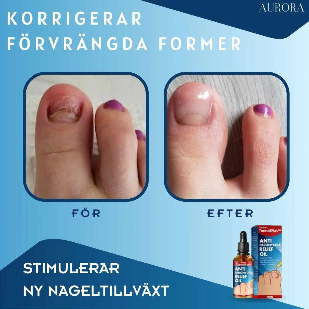 1 + 1 GRATIS IDAG | ToePerfect™ - Läker tånaglar och handnaglar - Image 6