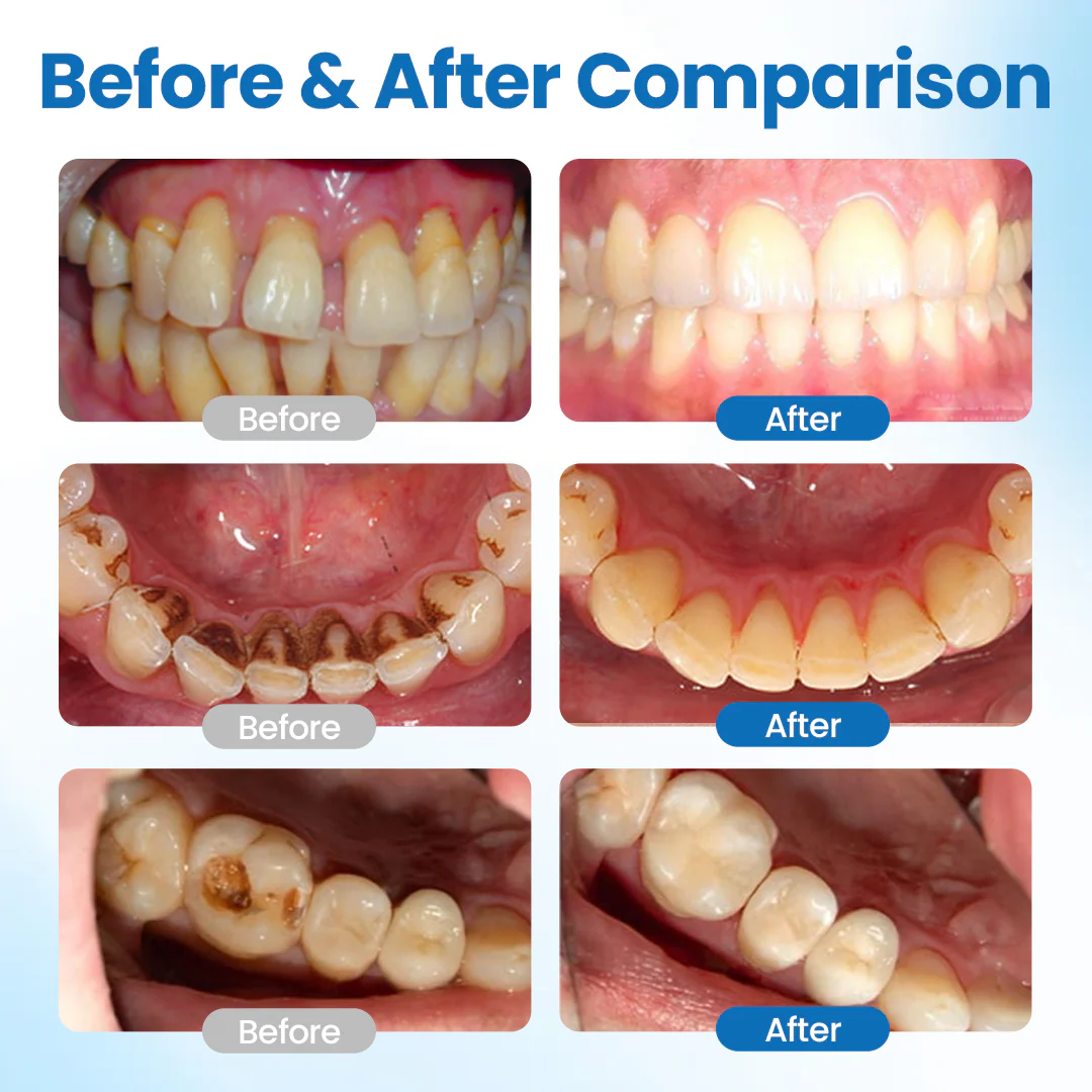 1 + 1 GRATIS IDAG | ToothArmor™ - Image 2