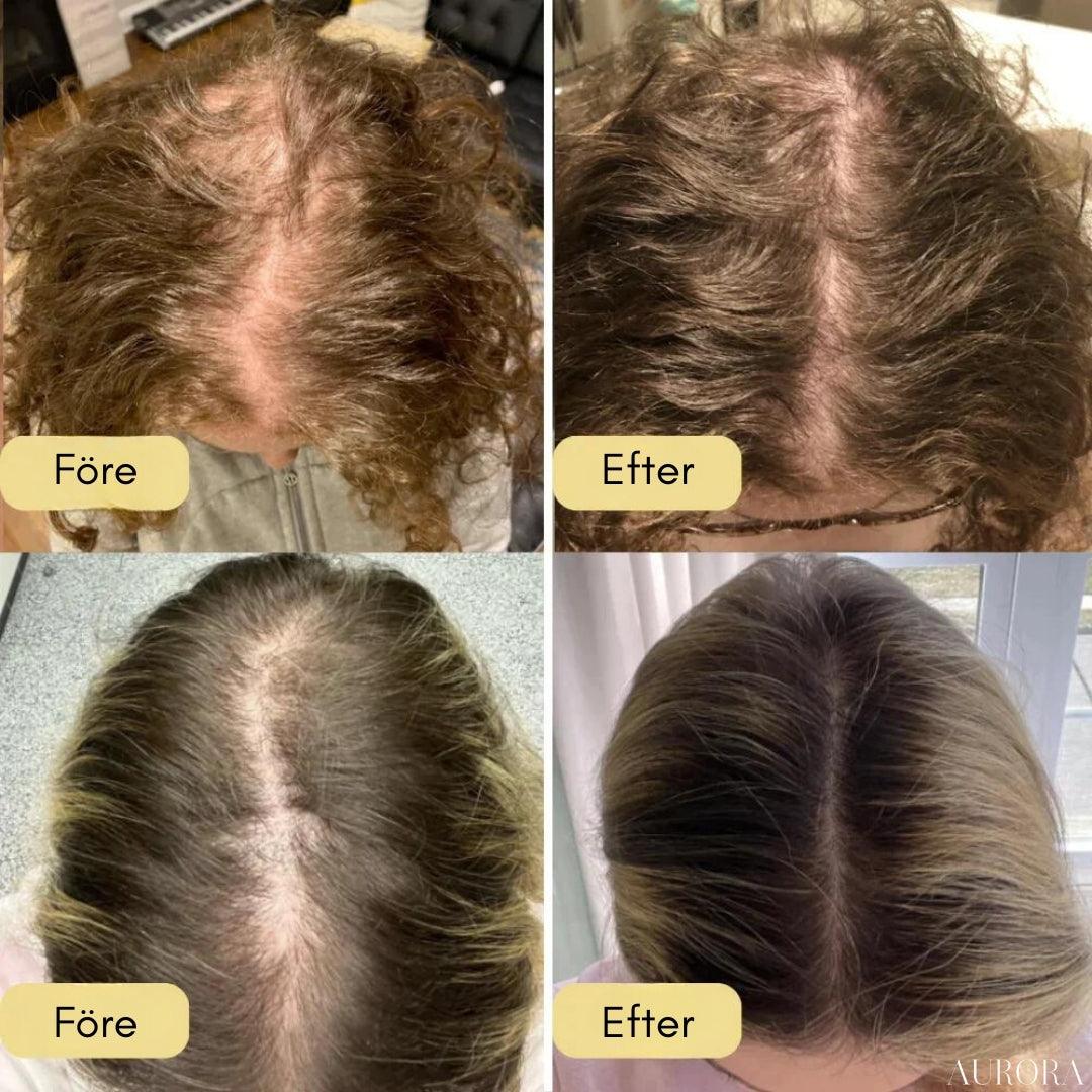 TILLFÄLLIGT 50% RABATT | VitalGrow™ |  Din Naturliga Oljebehandling För Hårväxt