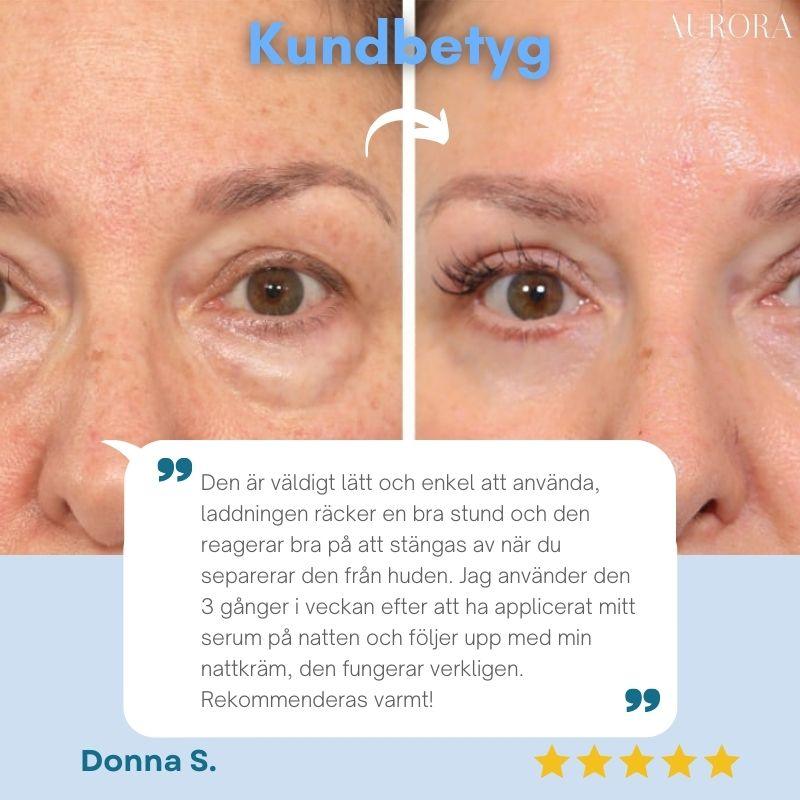 TILLFÄLLIGT 50% RABATT | YouthfulAura™ - Bekväm ansiktslyftning - Image 7