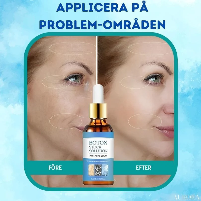1 + 1 GRATIS IDAG | YouthGlow™ | Botox Antialterung Serum - Image 5